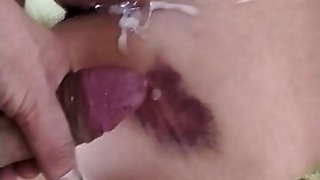 Fucking my boyfriend damaged backside doggie with a cumshot